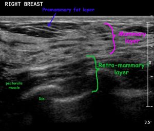 breast-normal